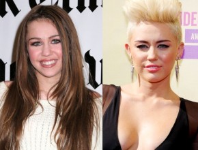 Miley Cyrus before and after plastic surgery