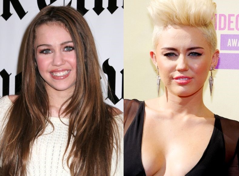 Miley Cyrus before and after plastic surgery.