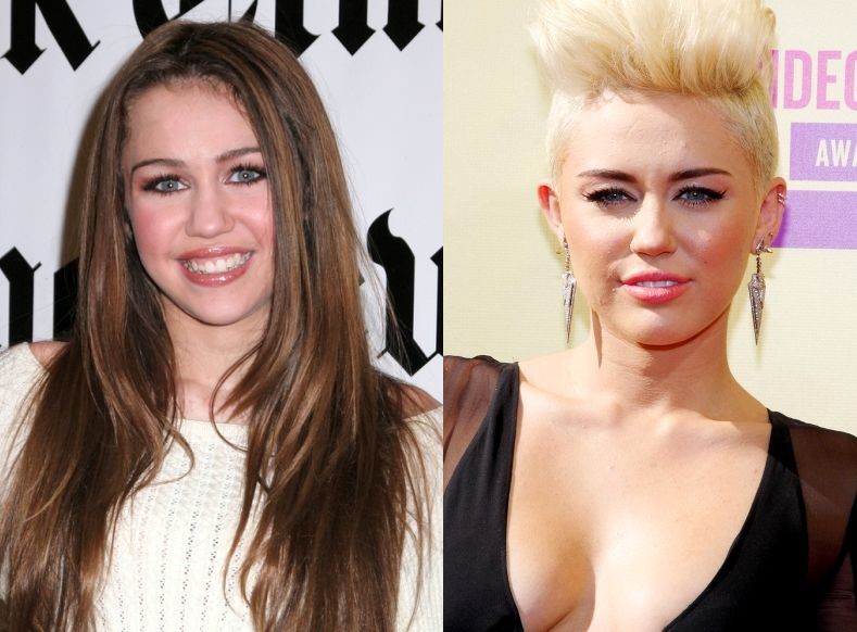 Miley Cyrus before and after plastic surgery