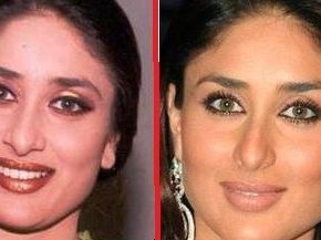 Kareena Kapoor after nose job