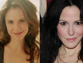 Mary Louise Parker before and after plastic surgery