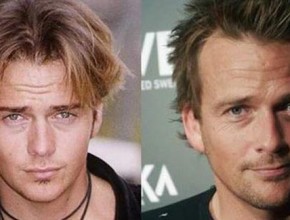 Sean Patrick Flanery before and after plastic surgery