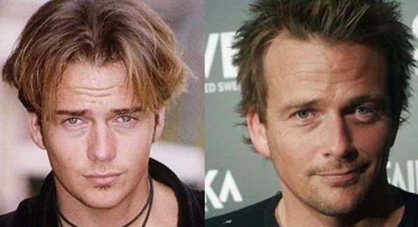 Sean Patrick Flanery before and after plastic surgery