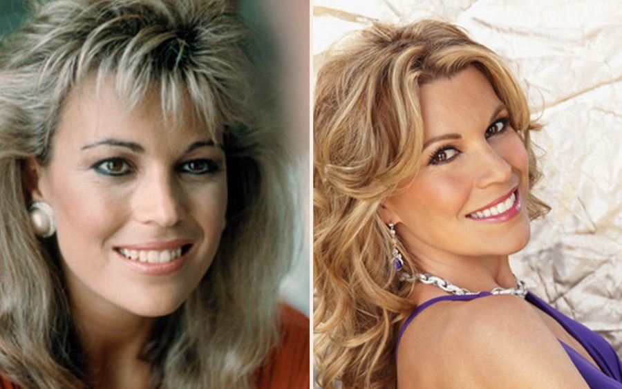 Vanna White before and after plastic surgery.