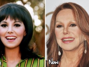 Marlo Thomas before and after plastic surgery