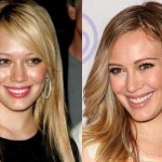 Hilary Duff before and After Plastic Surgery