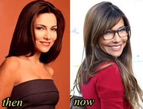 Vanessa Marcil before and after plastic surgery