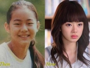 Seo Woo before and after plastic surgery