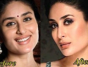 Kareena Kapoor after nose job