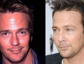 Sean Patrick Flanery before and after plastic surgery