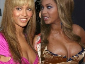 Beyonce before and after plastic surgery