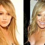 Hilary Duff Before and After Plastic Surgery