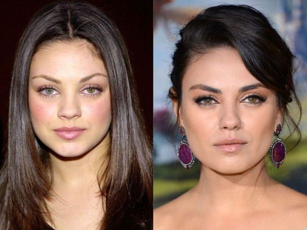 MIla Kunis before and after plastic surgery