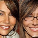 Vanessa Marcil before and after plastic surgery