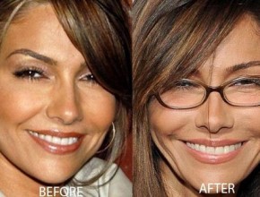 Vanessa Marcil before and after plastic surgery