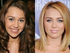 Miley Cyrus before and after plastic surgery