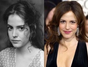 Mary Louise Parker before and after plastic surgery