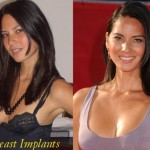 Lisa Olivia Munn before and after breast implants