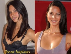 Lisa Olivia Munn before and after breast implants