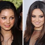 Mila Kunis before and after plastic surgery