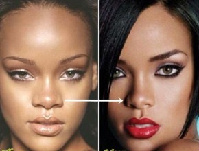 Rihanna before and after plastic surgery
