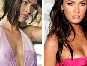Megan Fox before and after breast augmentation