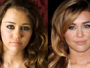 Miley Cyrus before and after plastic surgery