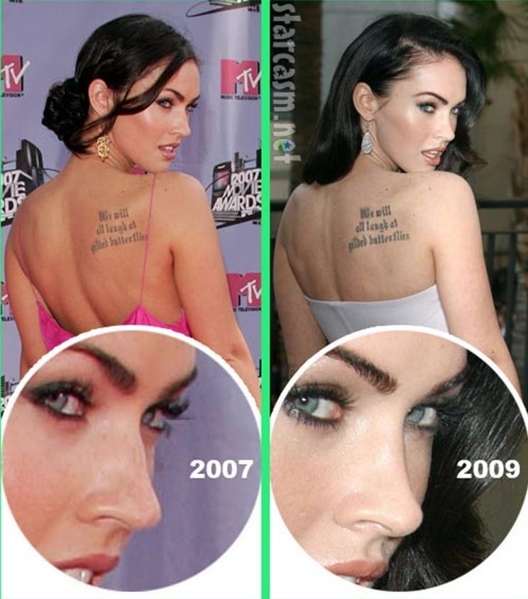 Megan Fox plastic surgery before and after nose job