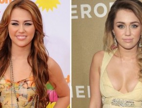 Miley Cyrus before and after breast augmentation