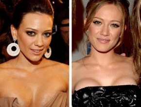Hilary Duff Before and After Plastic Surgery