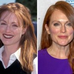 Julianne Moore plastic surgery - Then and now