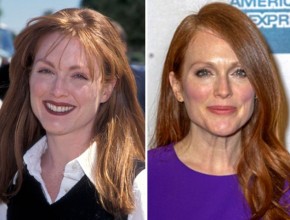 Julianne Moore plastic surgery - Then and now