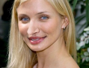 Cameron Diaz after plastic surgery 02