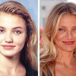 Cameron Diaz before and after plastic surgery 02