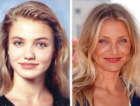 Cameron Diaz before and after plastic surgery 02