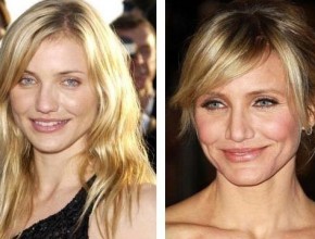Cameron Diaz before and after plastic surgery