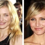 Cameron Diaz before and after plastic surgery 04