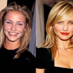 Cameron Diaz before and after plastic surgery 05