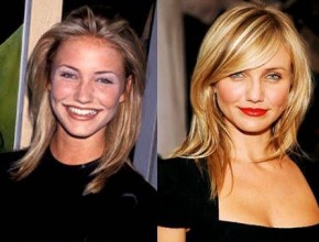 Cameron Diaz before and after plastic surgery 05