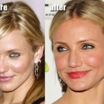 Cameron Diaz before and after plastic surgery 06