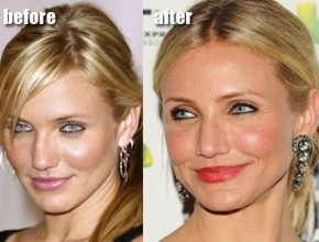 Cameron Diaz before and after plastic surgery 06