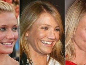 Cameron Diaz before and after plastic surgery 08