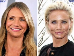 Cameron Diaz before and after plastic surgery