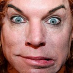 Carrot Top after plastic surgery 01