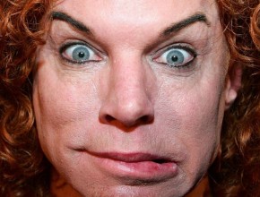 Carrot Top after plastic surgery 01