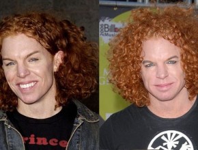 Carrot Top before and after plastic surgery 01