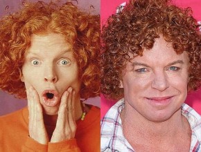 Carrot Top before and after plastic surgery