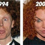 Carrot Top before and after plastic surgery 03