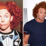 Carrot Top before and after plastic surgery 04