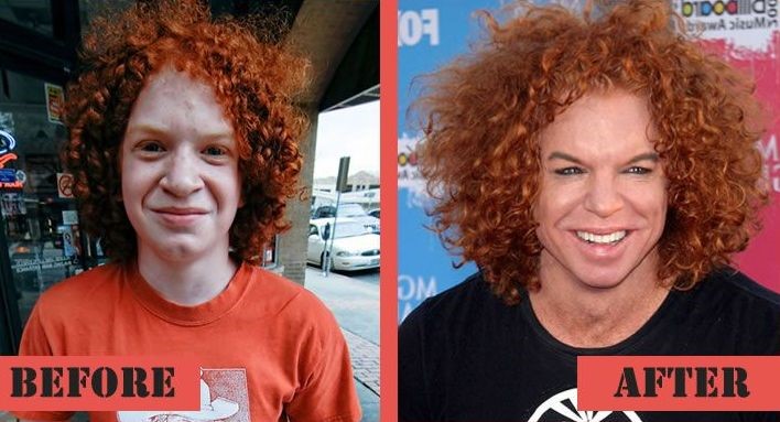 Image result for Carrot Top before and after plastic surgery